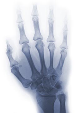 We help Medical Malpractice Victims